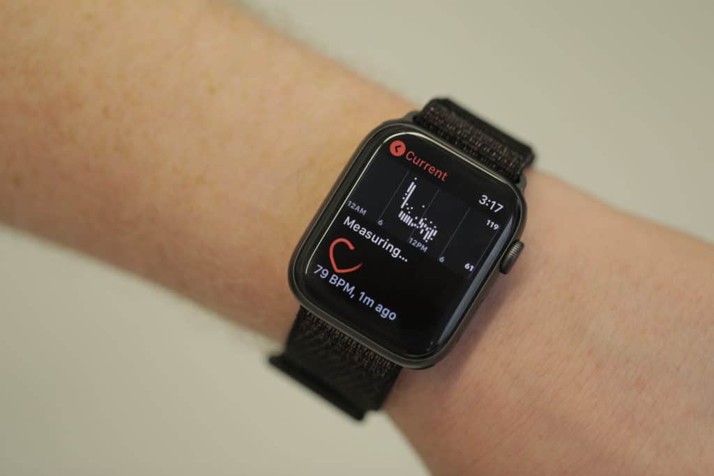Apple Watch Является ли Стив Возняк «любимым образцом технологий в мире» прямо сейчас