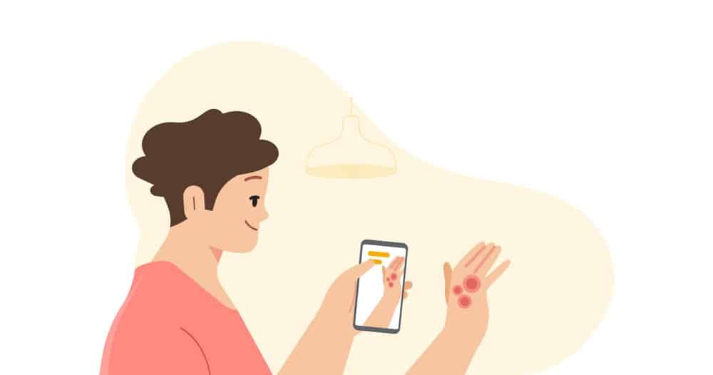 Инструмент Google Dermatology Assist Tool определяет распространенные кожные заболевания