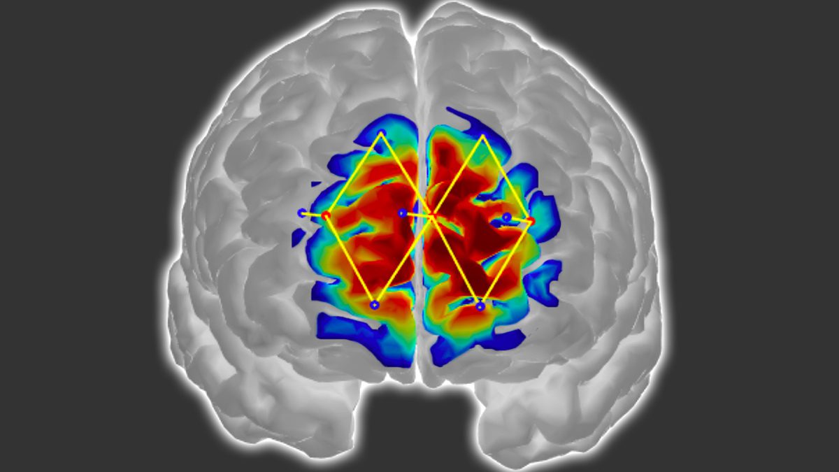 Исследователи Массачусетского технологического института будут измерять уровень боли пациента с помощью активности мозга
