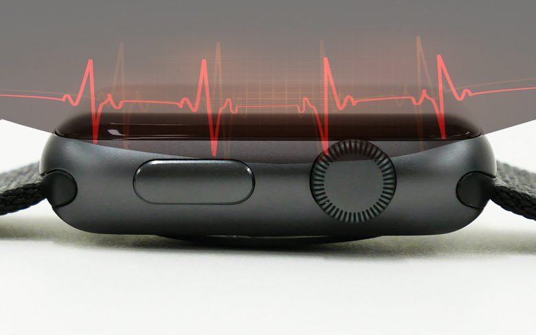 После ЭКГ, Apple Watch теперь можно измерять артериальное давление с помощью Force-Touch
