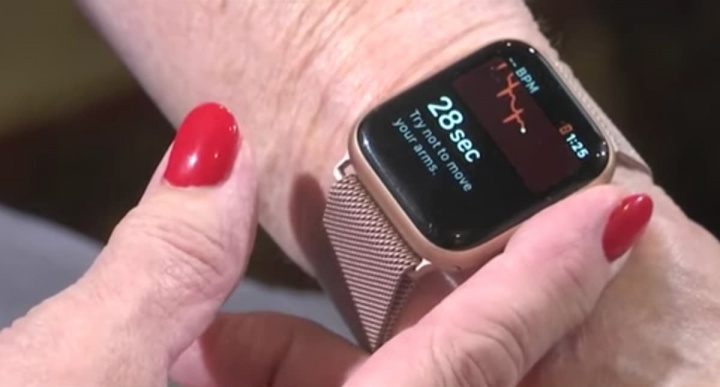 изображение Apple Watch Серия 4 Обнаружение мерцательной аритмии у женщины из Алабамы