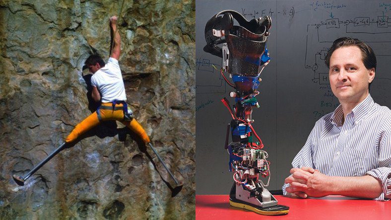 Человек, который взобрался на горы, создав себе бионические ноги