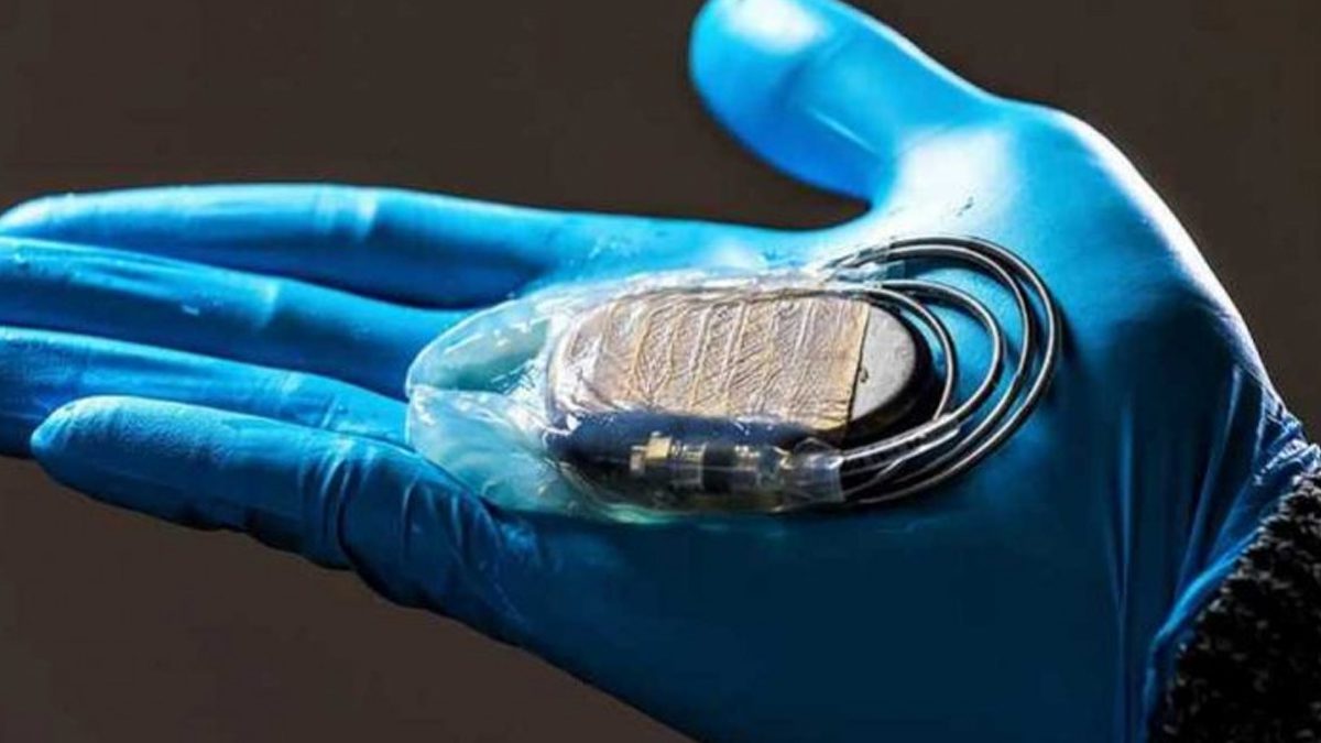 Ученые разработали специальную целлюлозную мембрану для защиты кардиостимуляторов